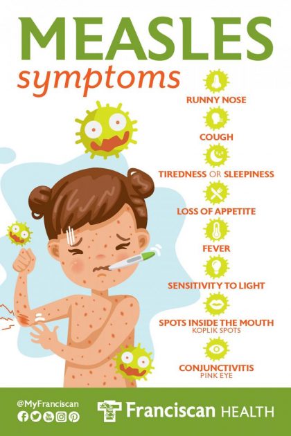 The Most Common Measles Symptoms Symptoms Of Virus 